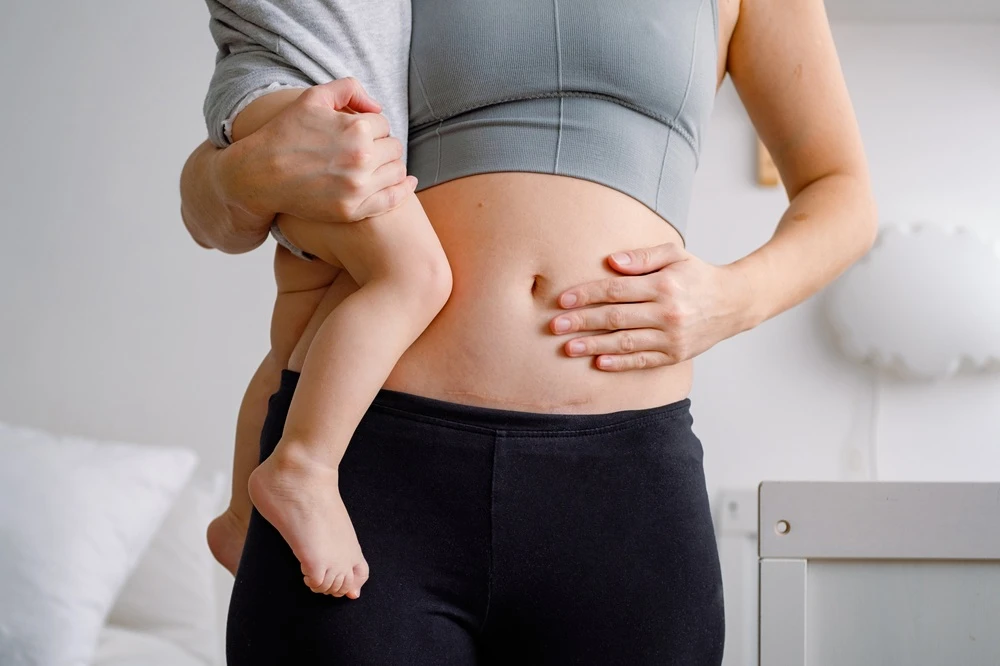 Medical Malpractice Causes of Erb's Palsy